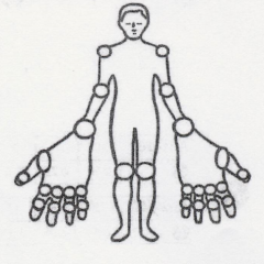 Rheumatoid Arthritis