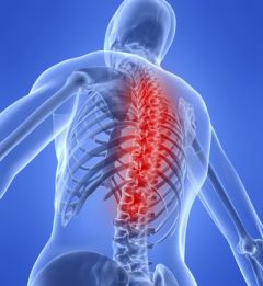 Ankylosing Spondylitis